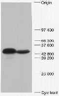 immunoblot using anti-VASP serum M4 (immunoGlobe.com)