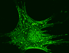 immunofluorescence using anti-VASP serum M4 (immunoGlobe.com)