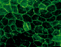 immunofluorescence using anti-VASP serum M4 (immunoGlobe.com)
