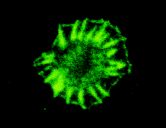 immunofluorescence using anti-VASP serum M4 (immunoGlobe.com)